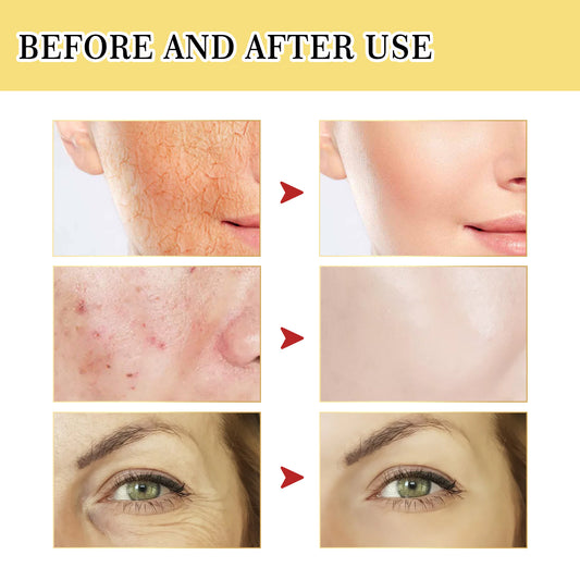 Snail Collagen Repair Serum — Anti-Aging + Deep Hydration (30ml)