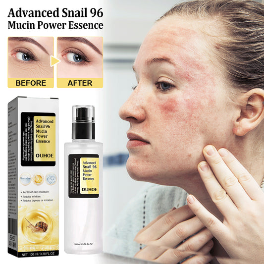 Snail Collagen Repair Serum — Anti-Aging + Deep Hydration (30ml)