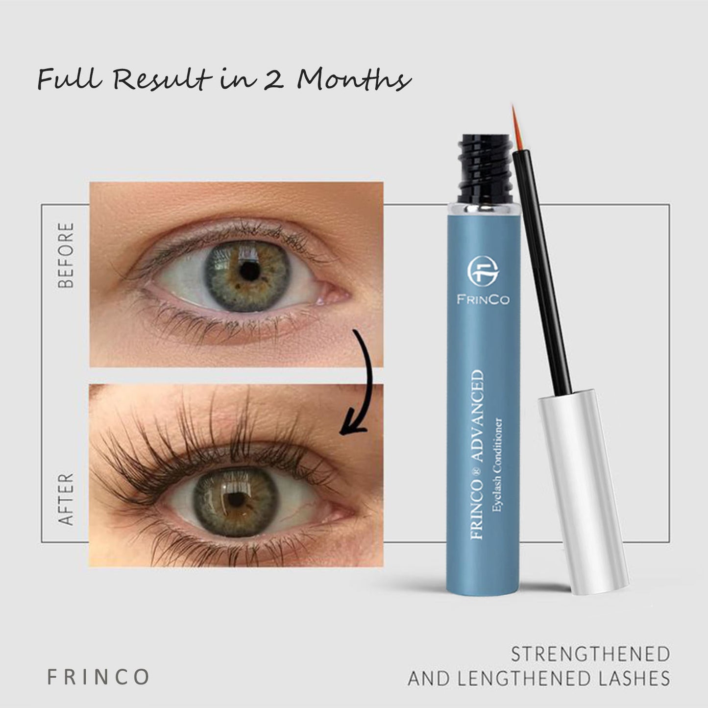 Lash & Brow Growth Serum — Fuller, Thicker Lashes in 4 Weeks (5ml)